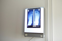 X-Ray of a pair of feet.