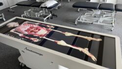 View of the Anatomage table displaying a full human skeleton with attached tissue.
